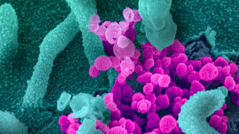 A scanning electron microscope image of SARS-CoV-2 emerging from the surface of human cells